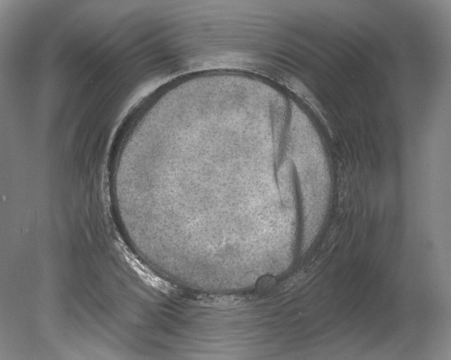 X0000078841072200612111549