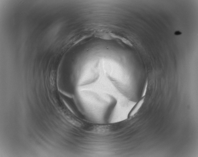 X0000078850078200612041917