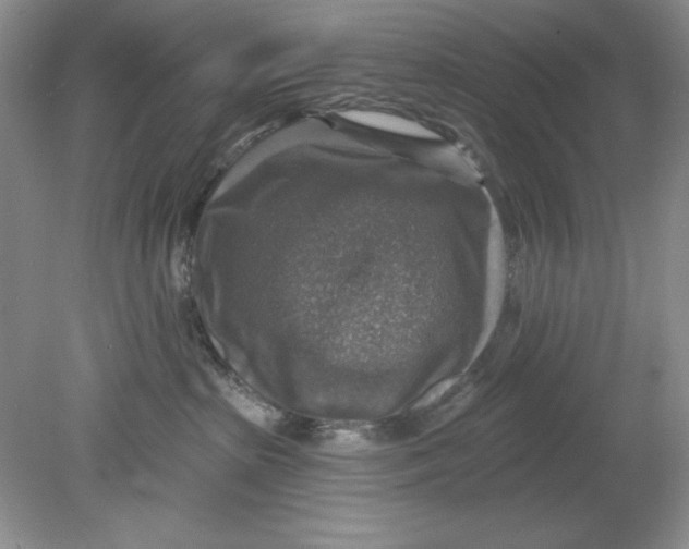 X0000078850285200612041914