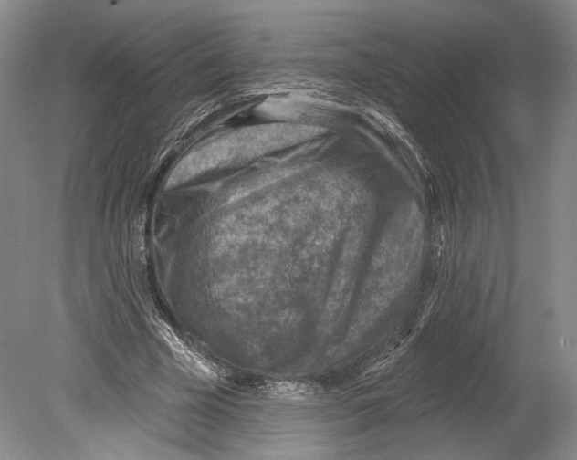 X0000078850585200612111624