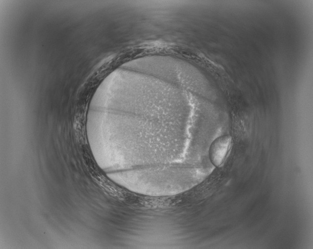 X0000078851254200612111612