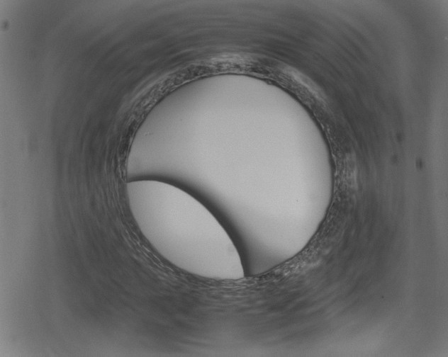 X0000078861015200611130954