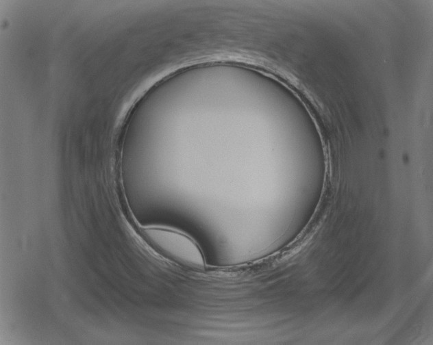 X0000078861500200611130946
