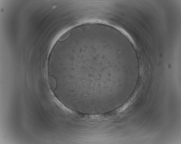 X0000078860903200611131200