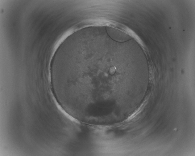 X0000078861095200611131157