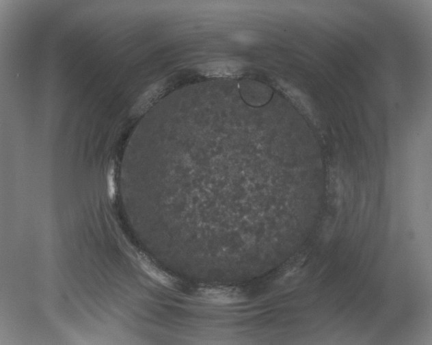 X0000078860069200611201324