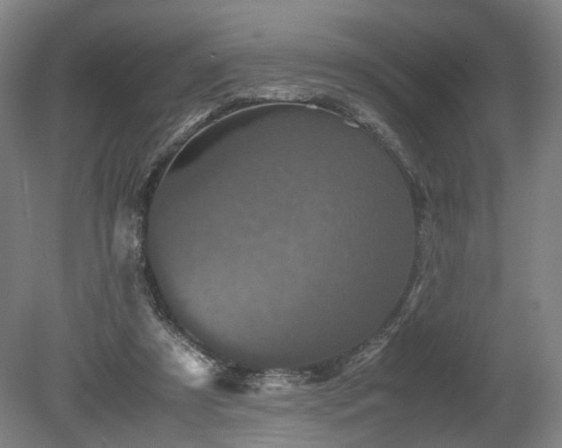 X0000078860305200611201320