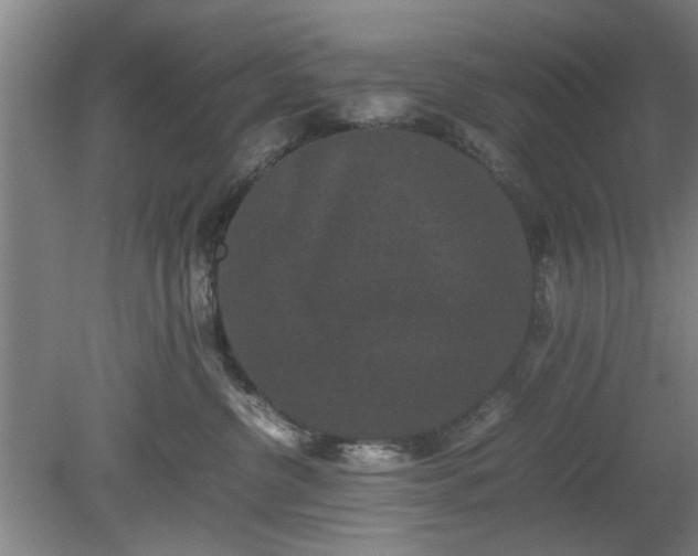 X0000078860380200611201320