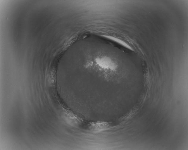 X0000078860517200611201317