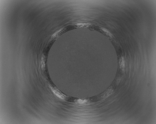 X0000078860570200611201316