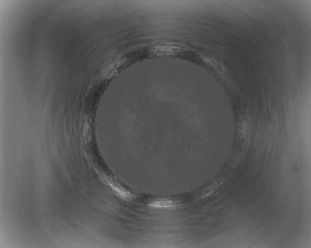 X0000078860759200611201313