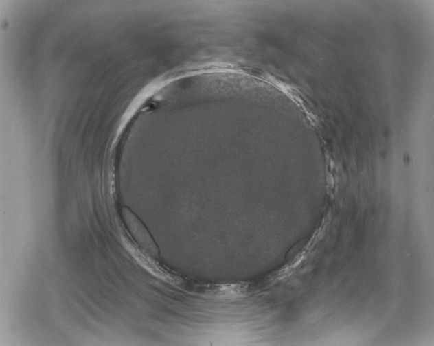 X0000078860056200611271422