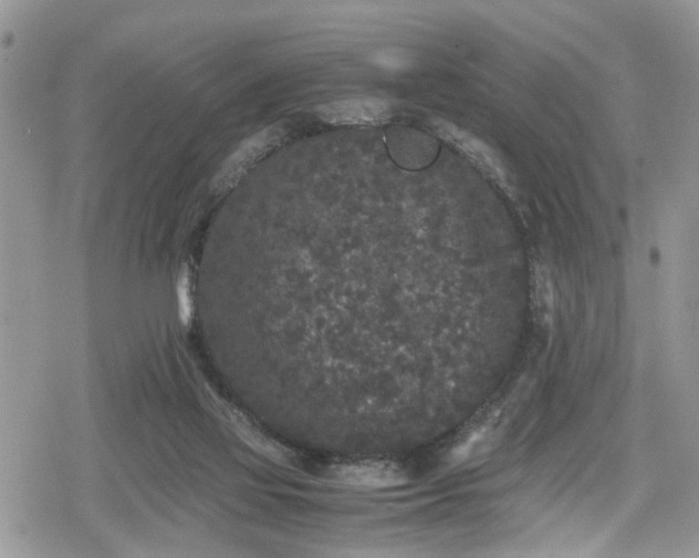 X0000078860069200611271422