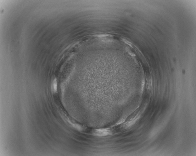 X0000078860095200611271422