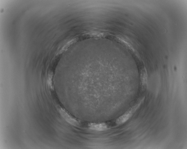 X0000078860185200611271421