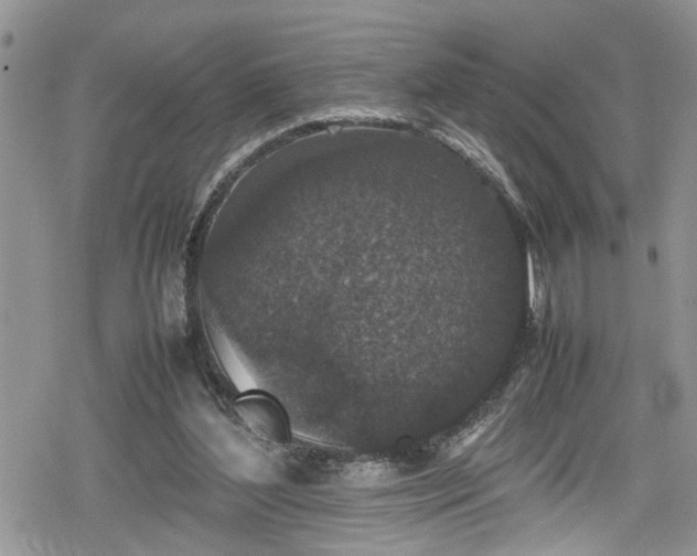 X0000078860204200611271420