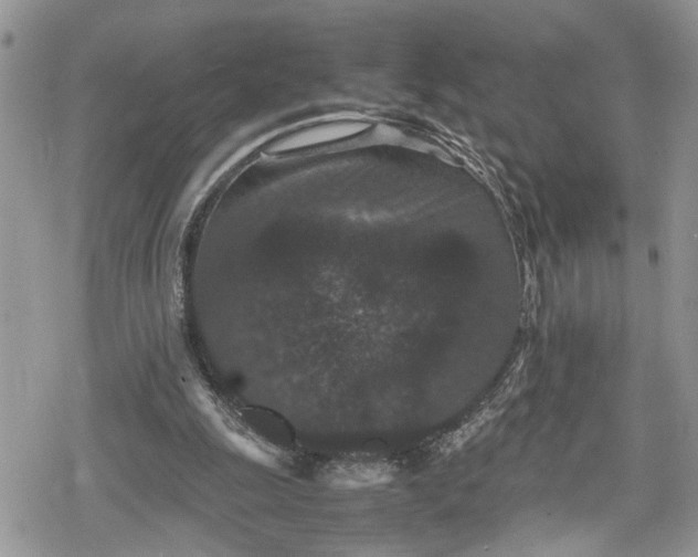 X0000078860247200611271419