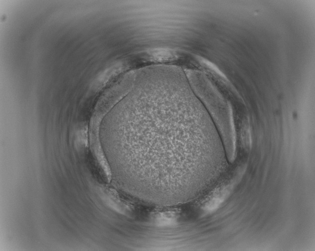 X0000078860368200611271418