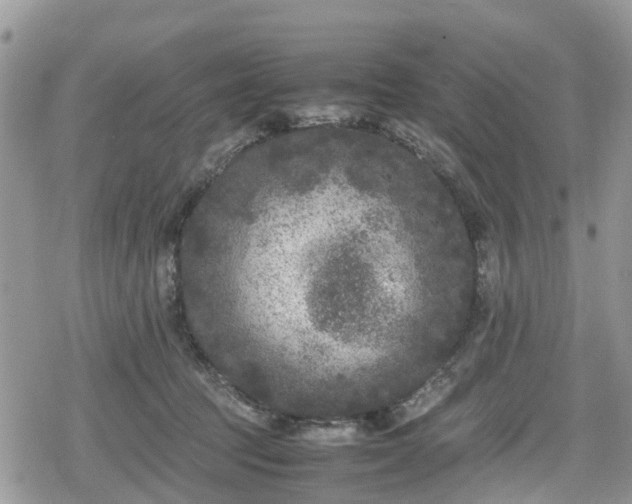 X0000078860369200611271418