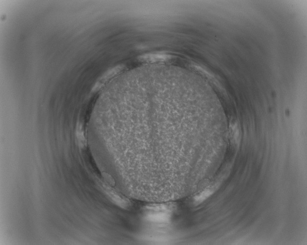 X0000078860381200611271418