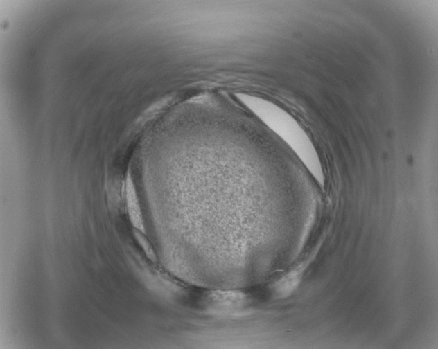 X0000078860429200611271416