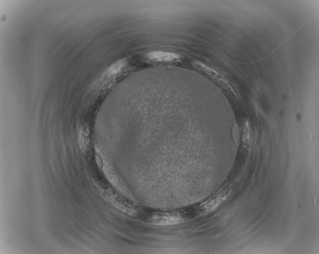 X0000078860559200611271414