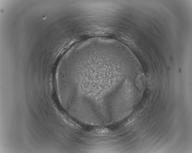 X0000078860642200611271413