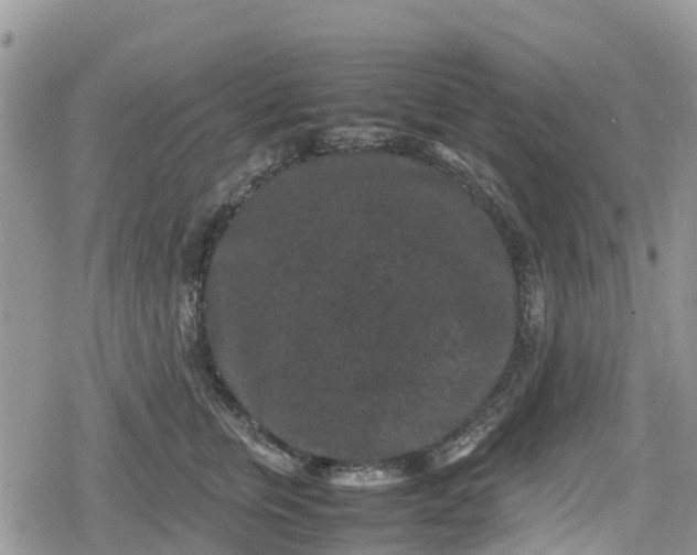 X0000078860759200611271411