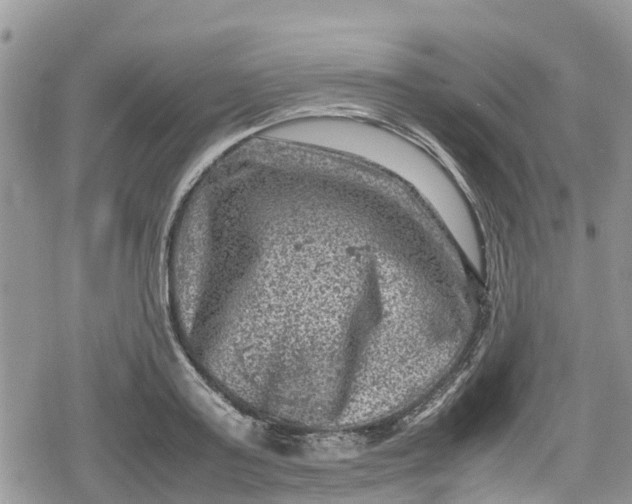 X0000078860795200611271410