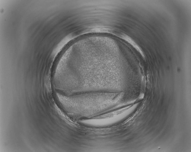 X0000078860972200611271407