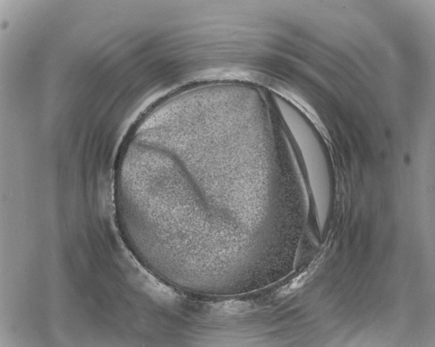 X0000078860992200611271407