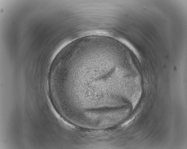 X0000078860999200611271407