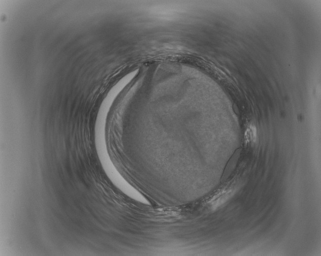 X0000078861156200611271404