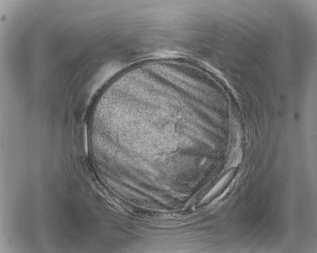 X0000078861171200611271404