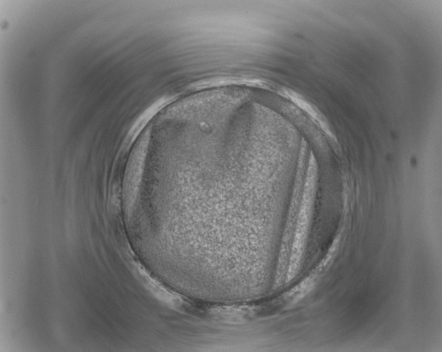 X0000078861185200611271404