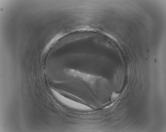 X0000078861359200611271401