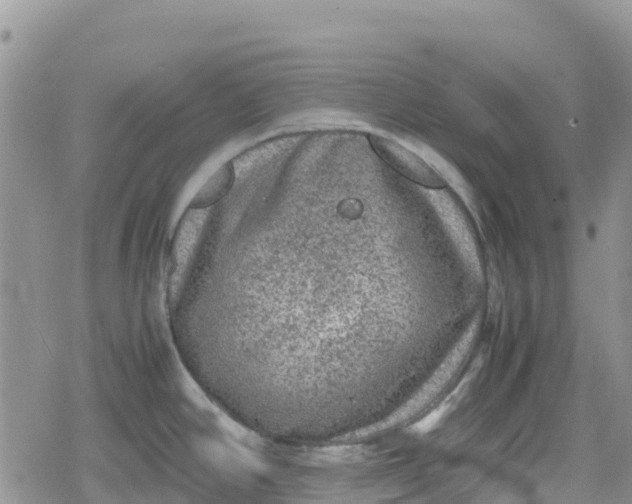 X0000078861390200611271401