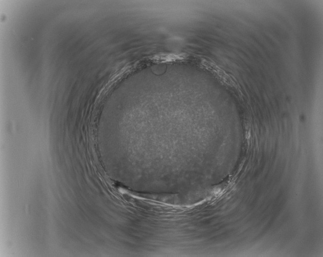 X0000078861393200611271400