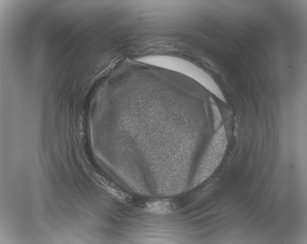 X0000078860362200612041938