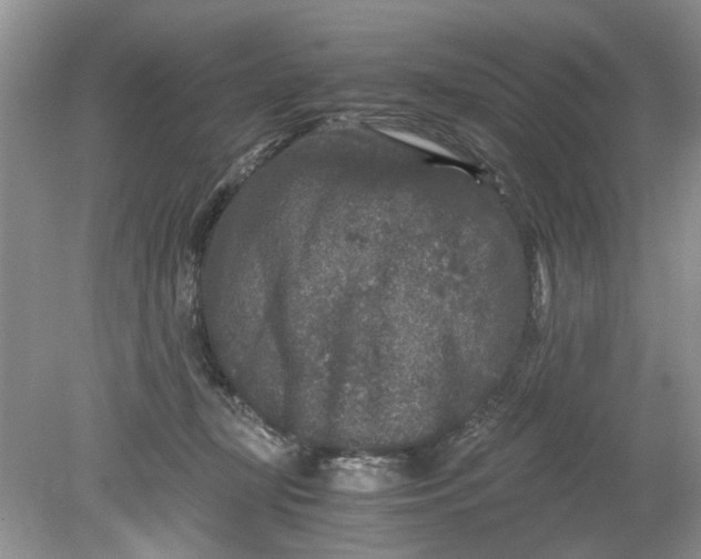 X0000078860367200612041938