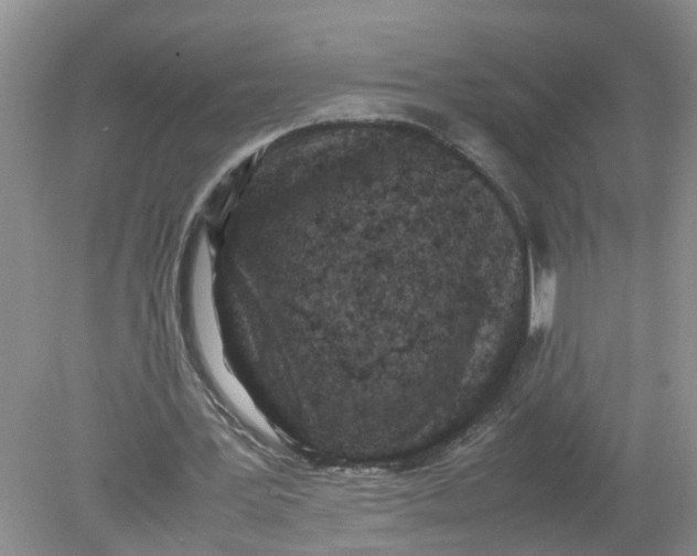 X0000078860387200612041938