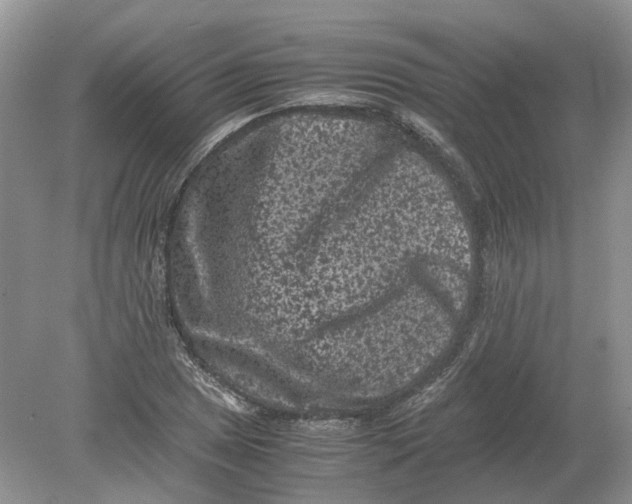 X0000078861025200612041927