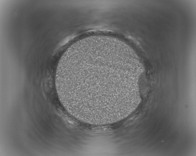 X0000078861159200612041924