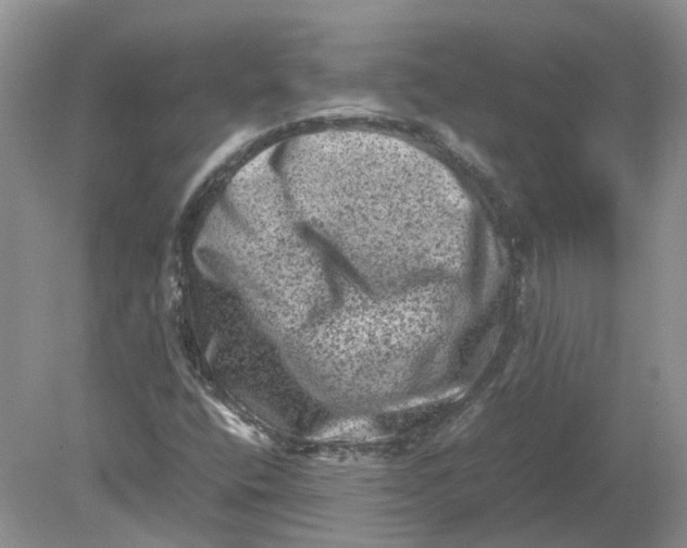 X0000078861400200612041920