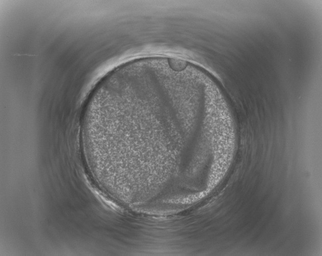 X0000078861507200612041918