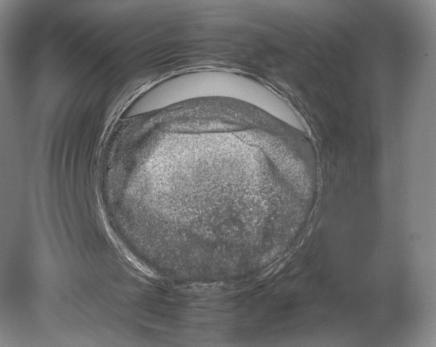 X0000078860049200612111658