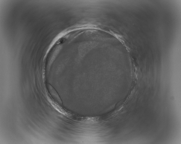 X0000078860056200612111658