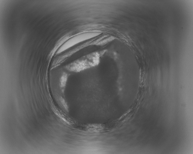X0000078860099200612111658
