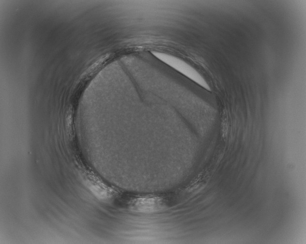 X0000078860314200612111654