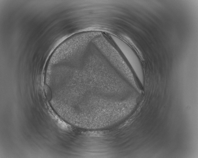 X0000078860900200612111644